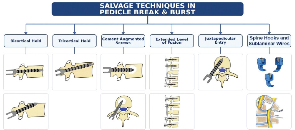 Figure 5: Salvage strategies after break–burst.
