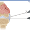 Creatine Supplementation in Pediatric Orthopedic Rehabilitation: A Translational Review and Proposed Clinical Trial Framework