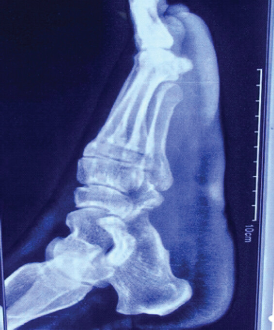Figure 6: Immediate post-operative radiograph.