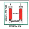 A Prospective Randomized Controlled Study Comparing the Efficacy of Platelet Rich Plasma Injection versus Steroid Injection in Lateral Epicondylitis