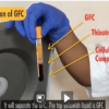 Comparative Efficacy of Intra-Articular Growth Factor Concentrate and Platelet-Rich Plasma Injections in Knee Osteoarthritis: An Evaluation of Clinical, Radiological, and Biomarker Outcomes