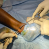 Comparative Outcomes of Hamstring Tendon versus Peroneus Longus Tendon Autograft in Arthroscopic Single-Bundle Anterior Cruciate Ligament Reconstruction: A Prospective Comparative Study