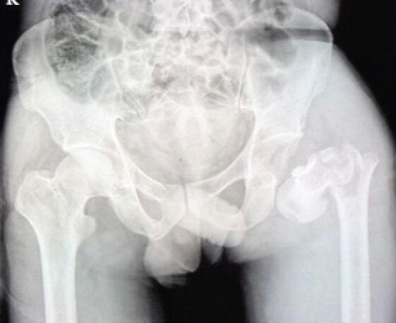 Figure 2: Intraoperative pictures.