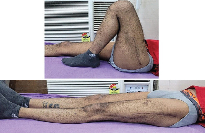 Figure 10: Full range of motion achieved at the knee and hip joints.