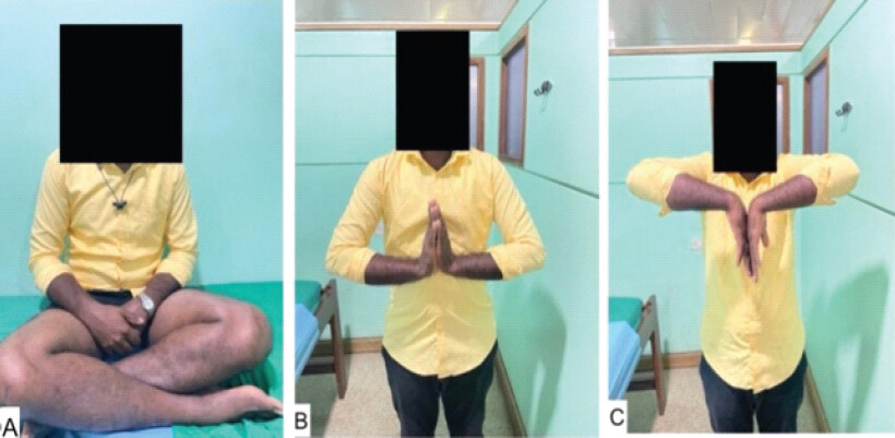 Figure 8: One-year clinical photographs showing satisfactory knee flexion (a) and bilateral wrist range of motion (b and c). The face has been masked to preserve patient confidentiality.