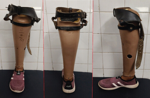 Figure 3: Photos of the prosthesis.