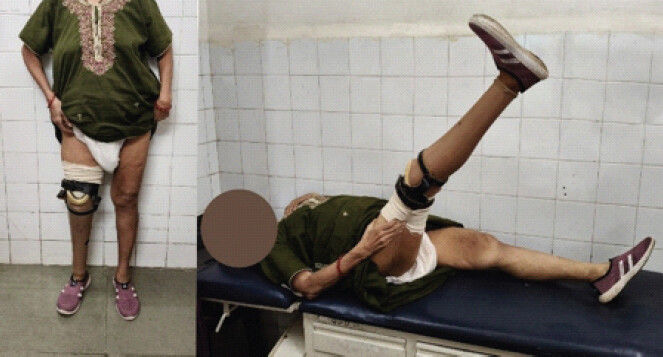 Figure 9: Post-operative clinical photos showing good functional outcome.