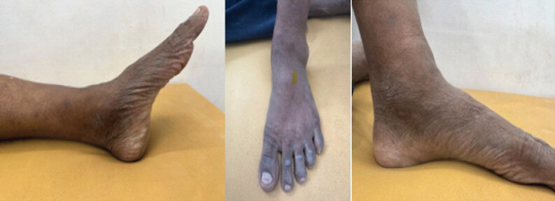 Figure 1: Pre-operative clinical presentation of the patient.