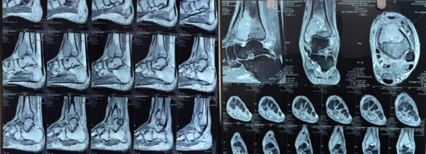 Figure 3: Different cuts in magnetic resonance imaging ankle.