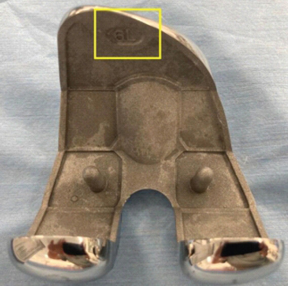 Figure 2: Marking on the actual implant indicating a different size, fixation type, and laterality from the external label (identifying information removed).