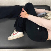Figure 1: Clinical photograph; clinical photograph at presentation demonstrating a mechanically locked knee fixed in hyperflexion following injury, with inability to actively or passively extend the joint.