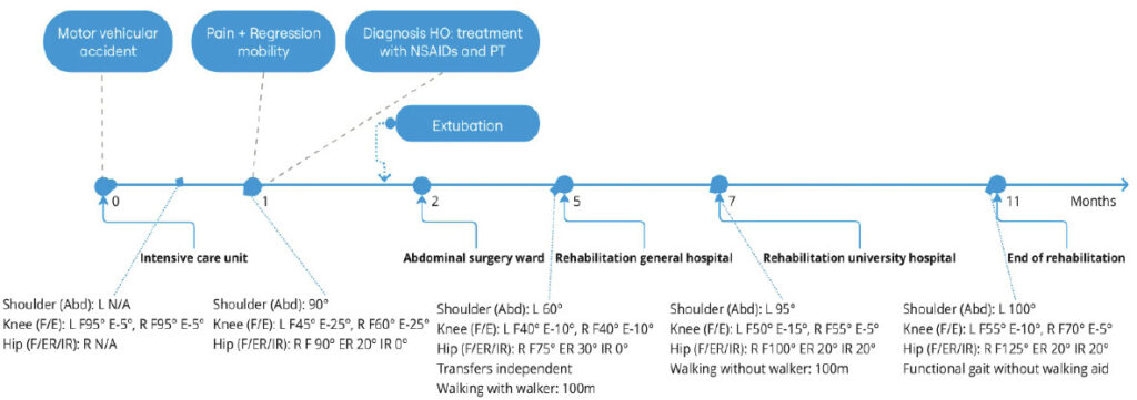 Figure 2: Timeline from initial trauma to completion of rehabilitation. Timeline illustrating the clinical course from initial trauma through intensive care unit stay, surgical management, and multidisciplinary rehabilitation. Serial measurements demonstrate progression of joint mobility in the left shoulder, right hip, and both knees over time. The figure highlights initial improvement, followed by functional deterioration associated with the development of heterotopic ossification, and subsequent gradual recovery during rehabilitation. R: Right, L: Left, N/A: Not available, HO: Heterotopic ossification, PT: Physical therapy, Abd: Abduction, F: Flexion, E: Extension, ER: External rotation, IR: Internal rotation.