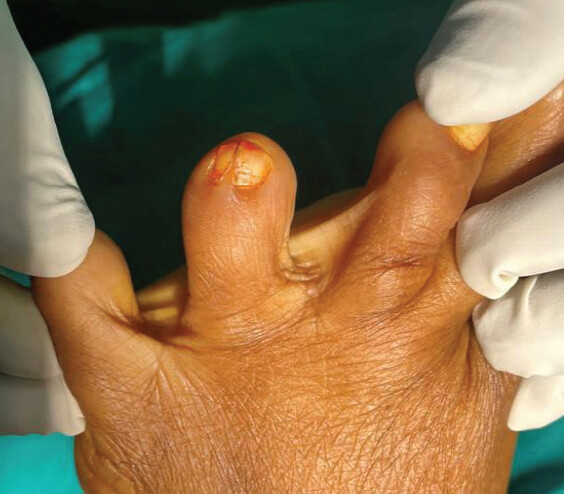 Figure 1: Clinical picture.