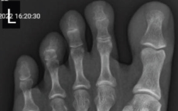 Figure 2: X-ray.