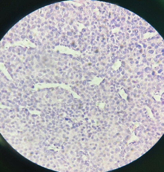 Figure 5: Microscopic appearance.