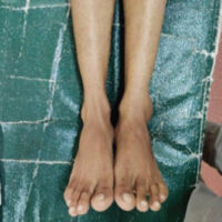 Figure 1: Clinical image.