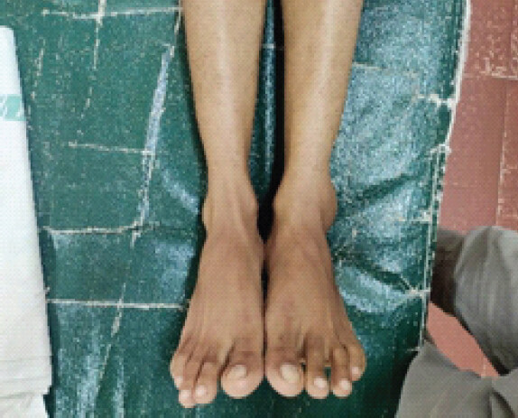 Figure 1: Clinical image.