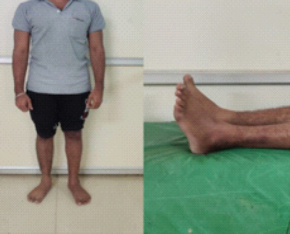 Figure 10: Clinical images.