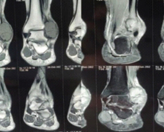 Figure 3: Magnetic resonance imaging images.