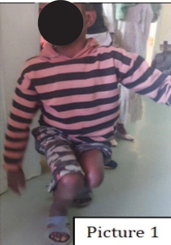 Figure 1: Pre-operative clinical photograph demonstrating the patient’s mobility mode, showing that due to the inability to walk upright and lack of walking aids, he was forced to crawl for mobility.