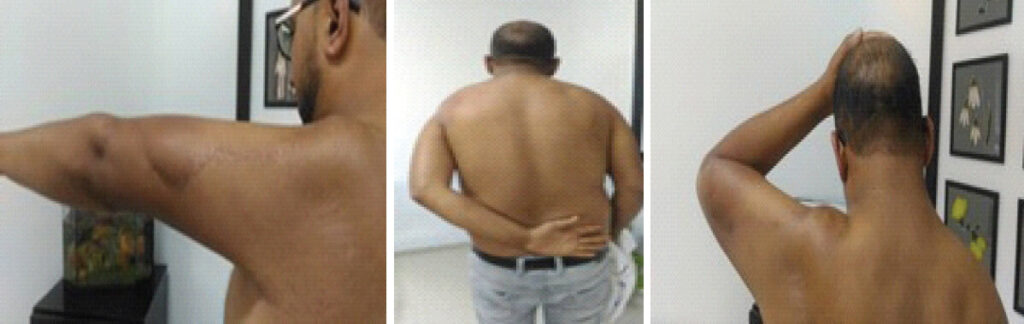 Figure 8: Clinical photographs at final follow-up (30 months).