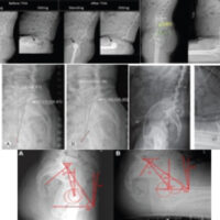 Figure 1: Pre-operative X-rays.