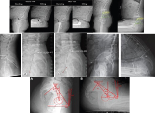 Figure 1: Pre-operative X-rays.