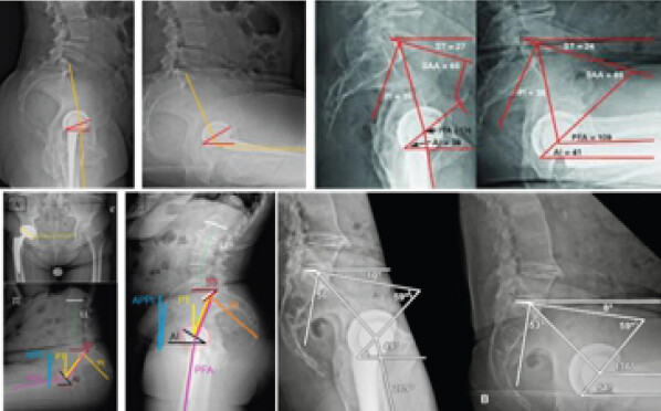 Figure 2: Post-operative X-rays.