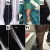 Outcomes of Primary Definitive Internal Fixation of Compound Fractures within 72 h of Injury: A Prospective Cohort Study