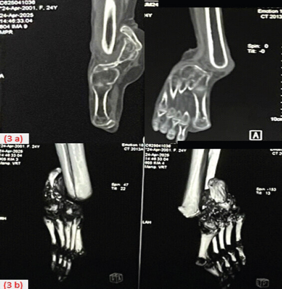 Figure 3: Computer tomography (a) images and 3D reconstruction (b).