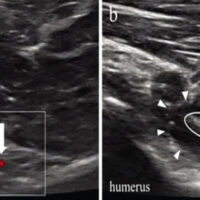 Figure 1: Ultrasound images