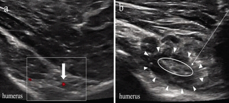Figure 1: Ultrasound images