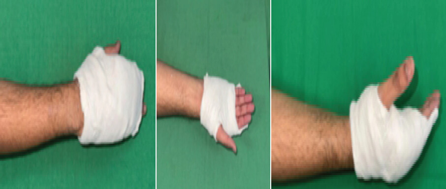 Figure 2: Design of the cast.