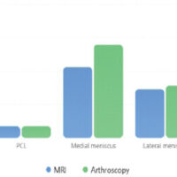 Figure 1: Distribution of injuries detected by magnetic resonance imaging and arthroscopy.