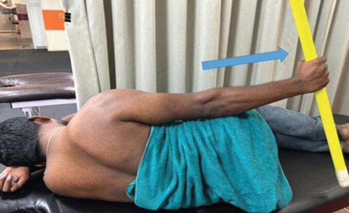 Figure 4: Coracohumeral ligament stretch.