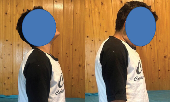 Figure 5: Clinical images of the patient on 7-year follow-up.
