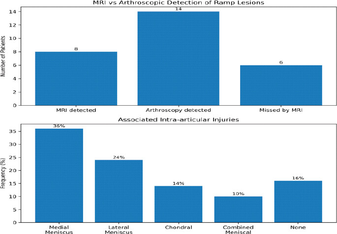 Figure 2: Comparison of magnetic resonance imaging and arthroscopic detection of ramp lesions, demonstrating the additional lesions identified by systematic arthroscopic evaluation, along with the distribution of associated intra-articular injuries.