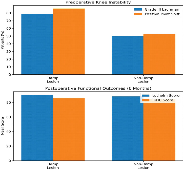 Figure 3: Comparison of pre-operative knee instability (Grade III Lachman and Pivot Shift tests) and post-operative functional outcomes (Lysholm and International Knee Documentation Committee scores) between patients with and without ramp lesions following anterior cruciate ligament reconstruction.