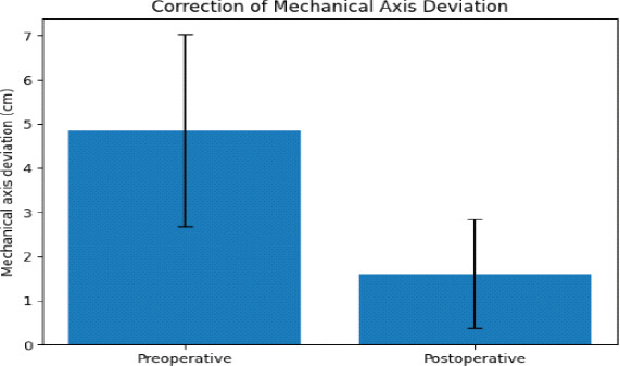 Figure 1: Correction of mechanical axis deviation