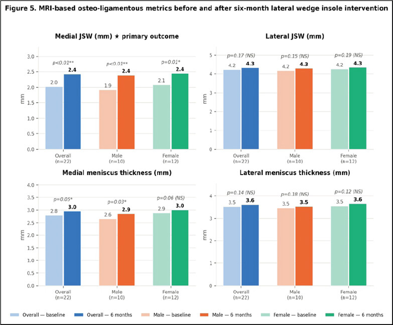 Figure 3: MRI-based osteoligamentous metrics before and after the 6-month lateral wedge insole intervention, stratified by sex. Mean MRI-based osteoligamentous measurements are shown at baseline (pre-intervention) and 6 months (post-intervention) for the 6-month analysis set (n = 22), male knees (n = 10), and female knees (n = 12). Paired bars within each group represent pre-intervention (lighter shade) and post-intervention (darker shade) values. The primary outcome variable – medial joint space width (JSW) is highlighted in amber and showed the most clinically significant improvement across all three groups: overall +0.40 mm (P < 0.01), males +0.46 mm (P < 0.01), females +0.36 mm (P = 0.01), with a significant sex × time interaction (P = 0.03). Medial meniscus thickness increased overall (+0.16 mm; P = 0.05) and in male knees (P = 0.03); this change approaches the precision limit of the measurement and is not interpreted as evidence of tissue regeneration. Lateral JSW and lateral meniscus thickness showed non-significant trends, reflecting the selective medial nature of the intervention effect. Significance was assessed by a paired t-test within group. JSW: Joint space width, MRI: Magnetic resonance imaging, NS: Not significant, *P < 0.05; **P < 0.01 (paired t-test, two-tailed).★ denotes primary outcome variable. Data source: Table 2, present study.