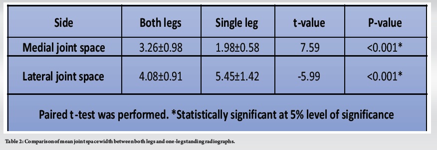 Single Stance Radiography of the Knee Joint – A Novel Approach to ...