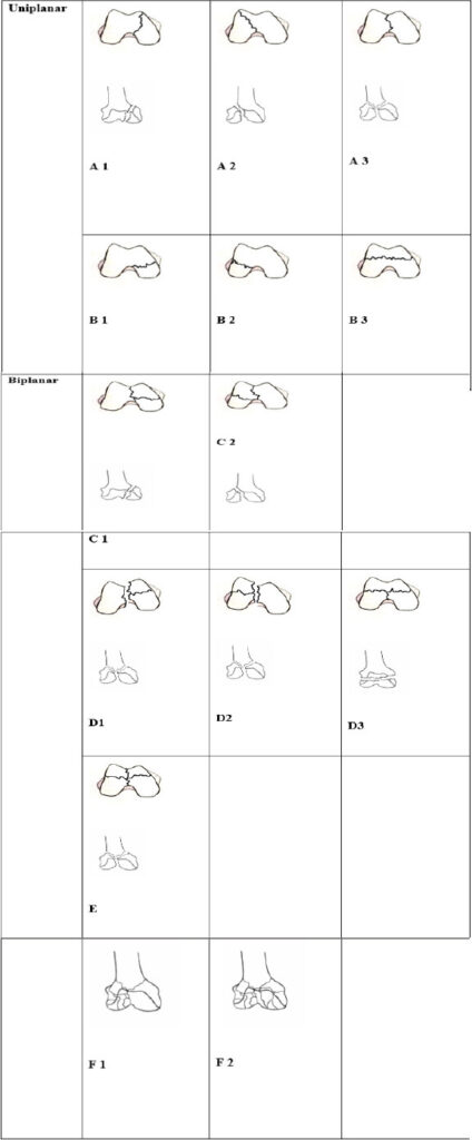 Figure 1: Pictorial description of the proposed computed tomography-based classification.
