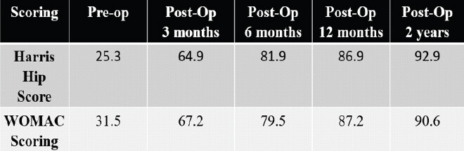Figure 5: Pre-operative and post-operative Harris hip score and the Western Ontario McMaster Universities Osteoarthritis Index score.