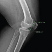 Figure 1: Caton–Deschamps ratio.
