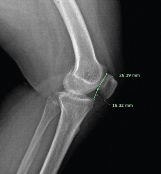 Figure 1: Caton–Deschamps ratio.