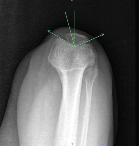 Figure 2: Congruence angle.