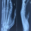 Burden, Treatment Patterns, and Functional Recovery of Hand Injuries in a Tertiary Hospital of Eastern India
