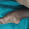 Comprehensive Analysis and Surgical Management of Neglected Congenital Talipes Equinovarus Using the Joshi’s External Stabilizing System: A 3-Year Longitudinal Case Study and Biomechanical Review