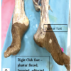 Cadaveric Dissection of Adult Neglected Talipes Equinovarus