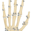 Acute Calcific Periarthritis of the 1st Metacarpophalangeal Joint: A Rare Diagnostic Challenge